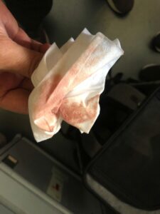 air france sangue